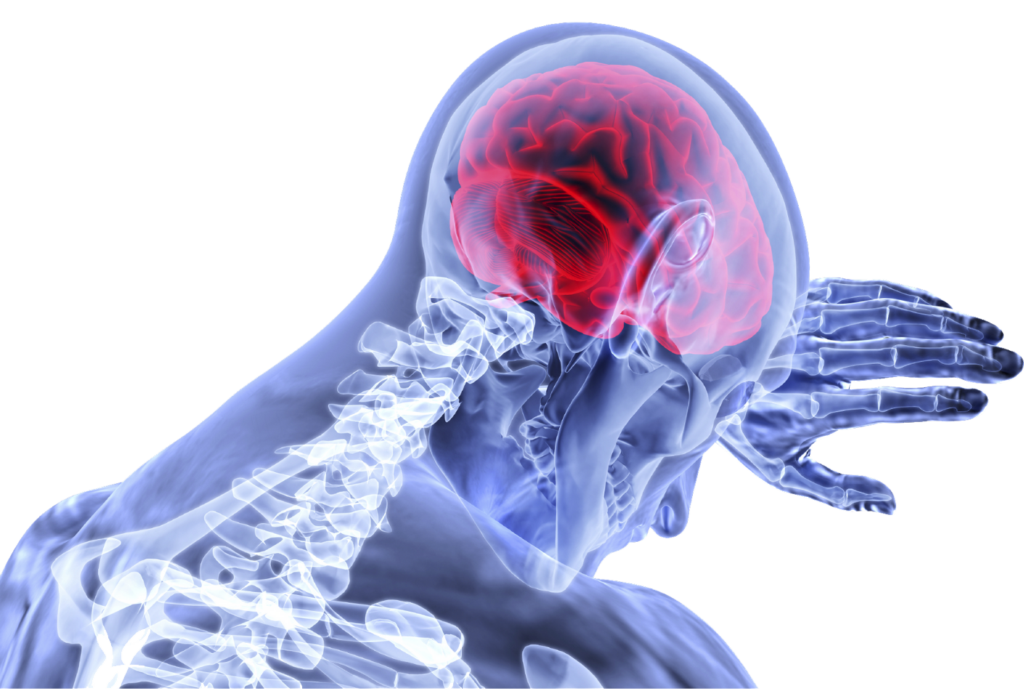 Illustration of inflammationand Brain tissue damage